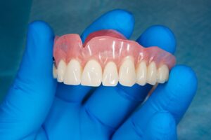 complete dentures in kondapur